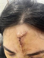 -痣斑堂·取大痣