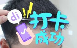 -大麦微针植发全国连锁