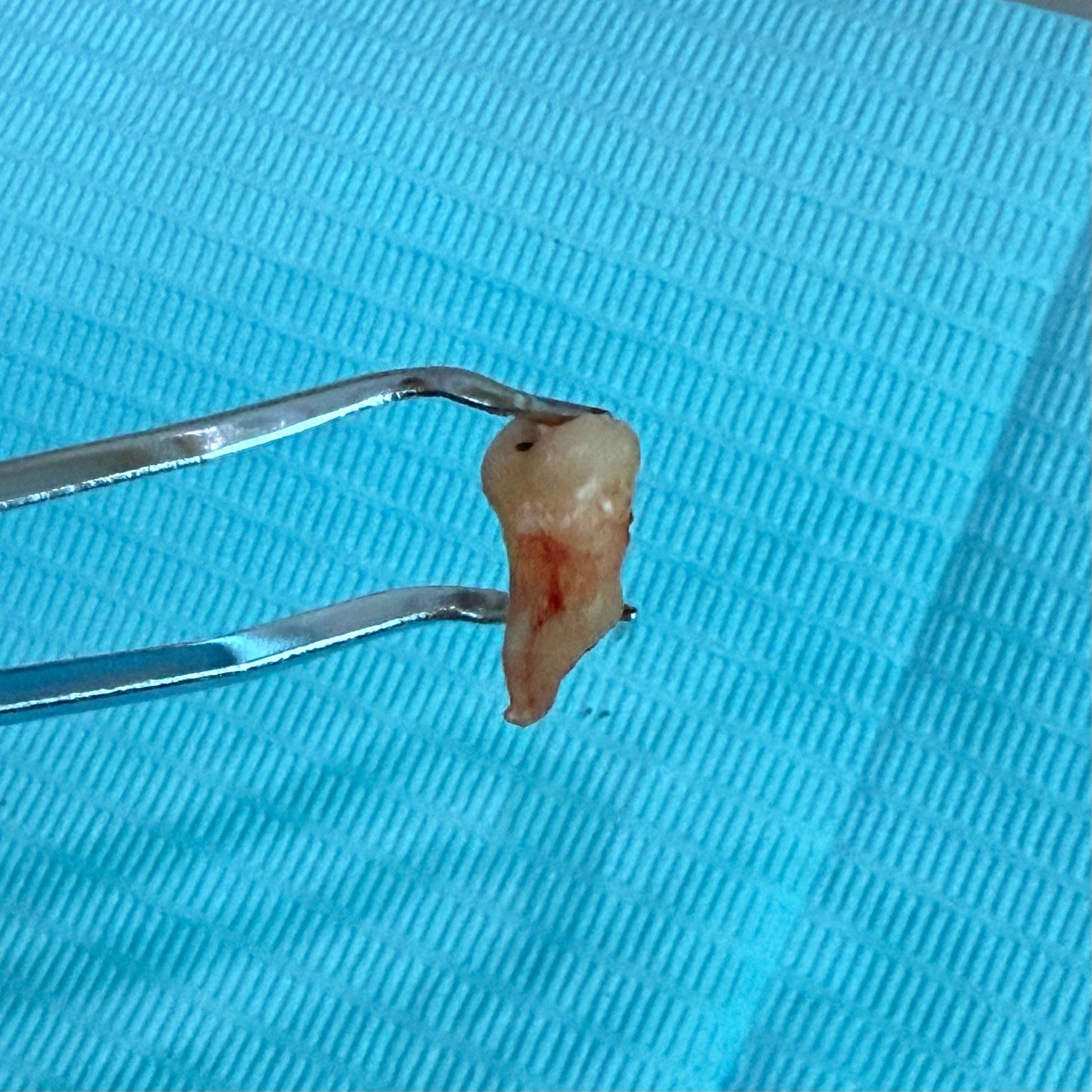 会翘二郎腿的智齿