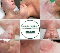 -VE专注问题肌·赛诺龙&科学美肤中心