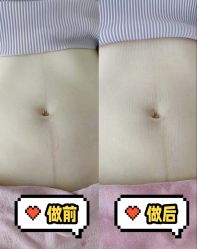 -奕美功能性体态调整·塑型·产后恢复(永利国际店)