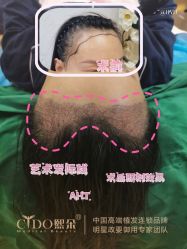-熙朵美学植发连锁