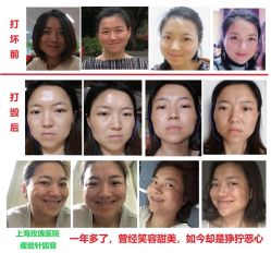 -上海玫瑰医疗美容医院