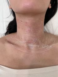 -海涛医疗美容·面部抗衰·注射美鼻