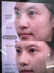 -Yestar艺星医疗美容医院