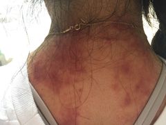 -智慧盲人按摩艾灸-颈肩腰膝疼痛调理(浦东店)