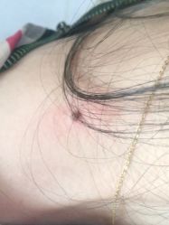 -北京美痣堂古方祛痣斑疣瘊