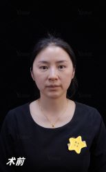 -Yestar重庆艺星医疗美容医院