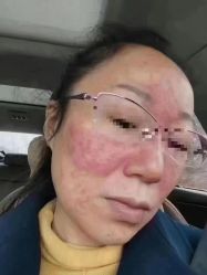 -蕾特恩专业祛痘·皮肤管理