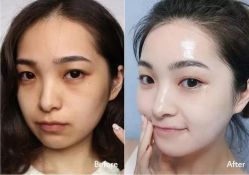 -上海时光整形外科医院