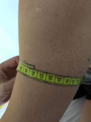 -肥三针腧穴瘦身馆