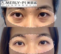 -MLP美丽派·问题肌疗愈中心