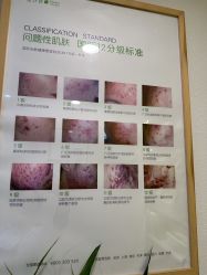 -塑青春&伊肤泉祛痘皮肤管理