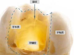 -团圆口腔·种植中心(锦江院区)