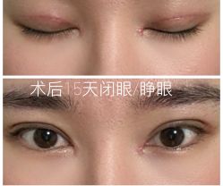 -JustHer宁波珈禾医疗美容医院
