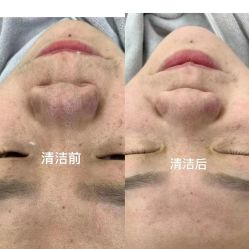 -蕾特恩专业祛痘·皮肤管理