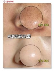 -苗坊净颜痘斑美容护肤连锁