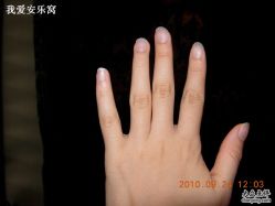 修整之前的手-摩睫+皮肤管理·科学美容中心