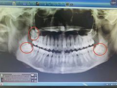 -深圳市人民医院(留医部)
