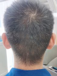 -雍禾植发全国连锁