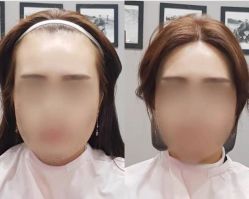 -发饰美男士增发补发假发定制店