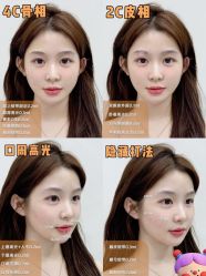 -深圳艺星医疗美容医院