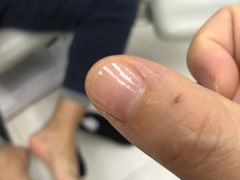 -新甲连锁灰指甲·甲沟炎·鸡眼(黑龙江路店)