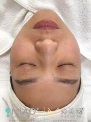 -韩国淼美颜皮肤管理官方直营店