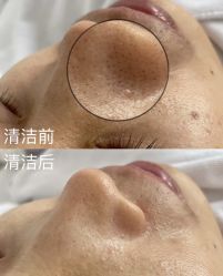 -SKIN79皮肤管理中心