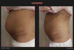 -杭州医学院附属妇儿医院