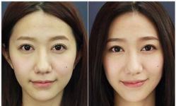 -CMS西美斯·美式医疗美容
