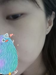 -圣嘉新医疗美容医院