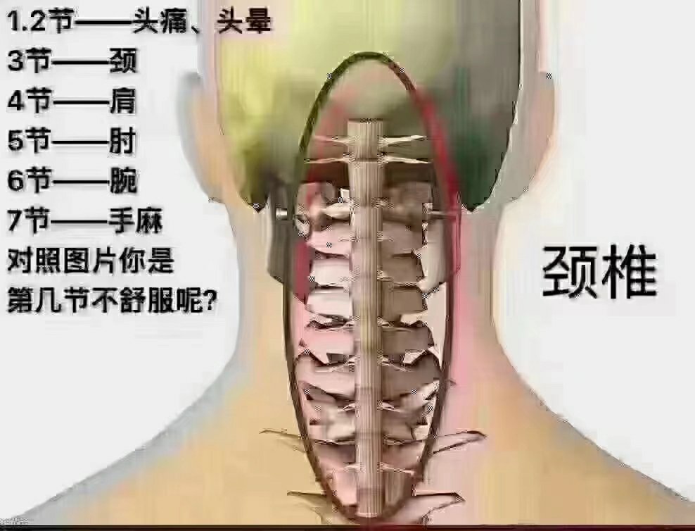 颈椎五六七节压迫神经图片