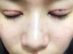 刚开好-上海华安整形外科门诊部