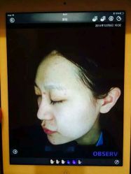 android_upload_pic-哈尔滨瑞丽医疗美容医院