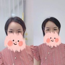 点击看大图 -美匠半永久纹眉
