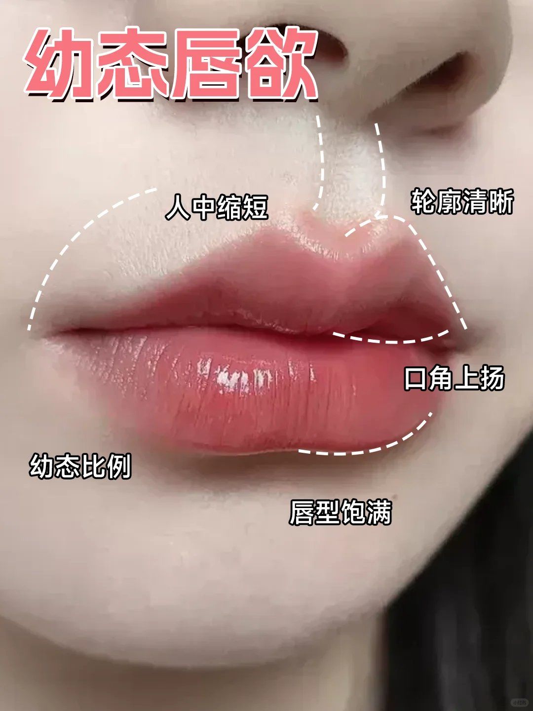 嘴唇干瘪不饱满\\n2人中过长\\n3嘴角下垂\\n4口角囊袋\\n5