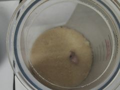 -宁耳听力助听器奥迪康峰力西门子斯达克(静安闸北店)