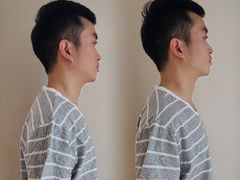 -FACE·日本小颜美容整骨(福田店)
