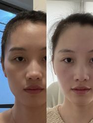 -上海伊莱美医疗美容医院