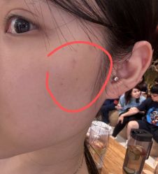 -广州美莱医疗美容医院