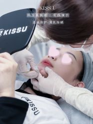 -KISS U 国际美学