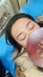 点击看大图 体验后-重庆联合丽格第五医疗美容医院