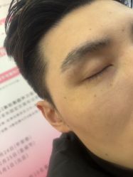 -长沙雅美医疗美容医院