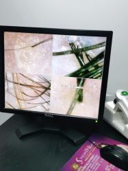 -章光101防脱养发荟