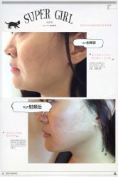 光SPA小V脸-光SPA科技美肤