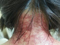 -来康盲人按摩(惠民北街店)