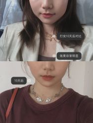 -上海漾颜医疗美容