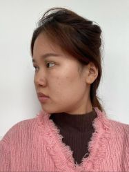 -广东韩妃整形外科医院