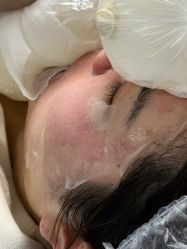 -长沙雅美医疗美容医院